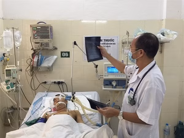 Điều trị SXH tại Bệnh viện Bạch Mai