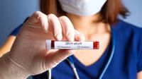 [ẢNH] Anh nghi ngờ chất lượng hàng triệu bộ kit xét nghiệm Covid-19 từ Trung Quốc