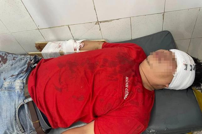 Nạn nhân được bác sĩ nối cánh tay Nạn nhân được bác sĩ nối cánh tay