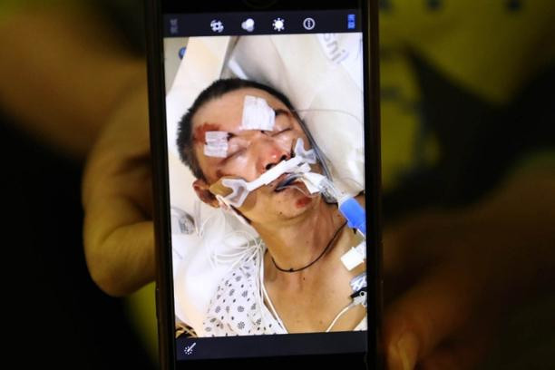 Nạn nhân Yao Pan Ma