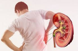 Việc tầm soát sức khỏe định kỳ giúp phát hiện sớm các vấn đề liên quan đến thận