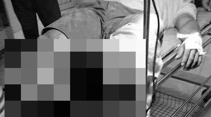 Nam thanh niên bị chém đứt lìa 2 phần 3 chân phải được cấp cứu. Ảnh: VOV