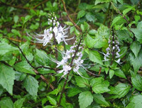 [ẢNH] Những dấu hiệu cảnh báo sớm bệnh sỏi thận bạn nên biết