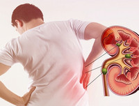 [ẢNH] Những dấu hiệu cảnh báo sớm bệnh sỏi thận bạn nên biết