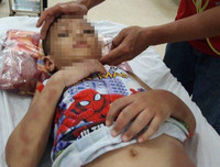 [ẢNH] Những vụ người thân bạo hành trẻ nhỏ gây bức xúc xã hội gần đây