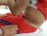 [ẢNH] Những vụ người thân bạo hành trẻ nhỏ gây bức xúc xã hội gần đây