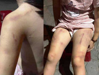 [ẢNH] Những vụ người thân bạo hành trẻ nhỏ gây bức xúc xã hội gần đây