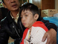 [ẢNH] Những vụ người thân bạo hành trẻ nhỏ gây bức xúc xã hội gần đây