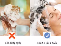 [ẢNH] Giật mình trước những thói quen cực hại cho cơ thể