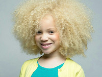 [ẢNH] Ngỡ ngàng trước vẻ đẹp khác biệt của những người mẫu bạch tạng nổi tiếng thế giới