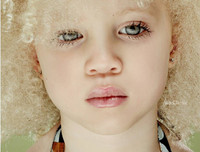 [ẢNH] Ngỡ ngàng trước vẻ đẹp khác biệt của những người mẫu bạch tạng nổi tiếng thế giới