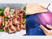 [ẢNH] Những thói quen sinh hoạt gây ung thư vú không ngờ tới