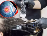 [ẢNH] Những thói quen sinh hoạt gây ung thư vú không ngờ tới