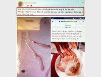 [ẢNH] Vụ người lạ bôi mặt, cầm đầu gà ăn xin: Cảnh giác những trò bịa đặt xấu xí