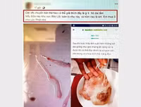 [ẢNH] Vụ người lạ bôi mặt, cầm đầu gà ăn xin: Cảnh giác những trò bịa đặt xấu xí