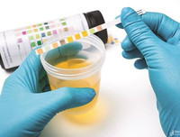 [ẢNH] Những dấu hiệu cảnh báo sớm bệnh sỏi thận bạn nên biết