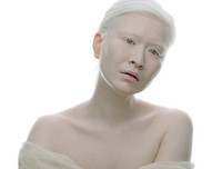 [ẢNH] Ngỡ ngàng trước vẻ đẹp khác biệt của những người mẫu bạch tạng nổi tiếng thế giới