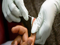 Quy trình xử lý chống phơi nhiễm HIV