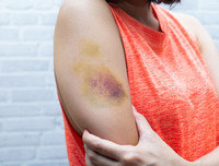 [ẢNH] 12 dấu hiệu bất thường trên cơ thể 