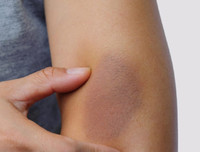 [ẢNH] 12 dấu hiệu bất thường trên cơ thể 