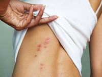 [ẢNH] Những công dụng bất ngờ từ vỏ chuối mà nhiều người chưa biết