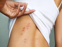 [ẢNH] Những công dụng bất ngờ từ vỏ chuối mà nhiều người chưa biết