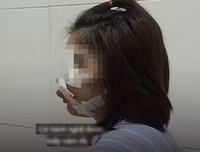 Hoại tử kinh hoàng trên cơ thể vì tiêm mỡ tự thân, chất làm đầy