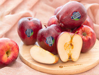 [ẢNH] Khi bị đau dạ dày nên ăn những loại thực phẩm nào?