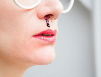 [ẢNH] Ăn dứa mùa hè (2): Dùng đúng cách để tránh 