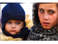 [ẢNH] Bí ẩn những đôi mắt dị thường hiếm gặp nhất trên thế giới