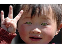 [ẢNH] Bí ẩn những đôi mắt dị thường hiếm gặp nhất trên thế giới