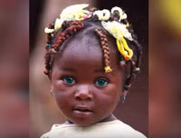 [ẢNH] Bí ẩn những đôi mắt dị thường hiếm gặp nhất trên thế giới