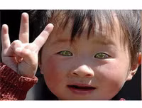 [ẢNH] Bí ẩn những đôi mắt dị thường hiếm gặp nhất trên thế giới