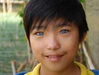 [ẢNH] Bí ẩn những đôi mắt dị thường hiếm gặp nhất trên thế giới