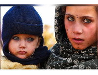 [ẢNH] Bí ẩn những đôi mắt dị thường hiếm gặp nhất trên thế giới