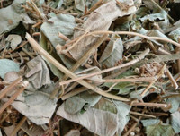 [ẢNH] Những dấu hiệu cảnh báo sớm bệnh sỏi thận bạn nên biết