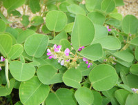 [ẢNH] Những dấu hiệu cảnh báo sớm bệnh sỏi thận bạn nên biết