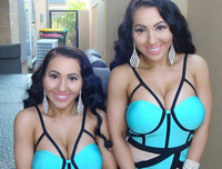 Cặp chị em song sinh chung bạn trai 8 năm tiếc nuối nhan sắc quá khứ vì thẩm mỹ quá đà