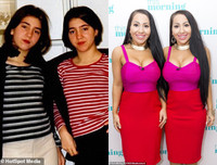 Cặp chị em song sinh chung bạn trai 8 năm tiếc nuối nhan sắc quá khứ vì thẩm mỹ quá đà