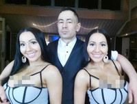 Cặp chị em song sinh chung bạn trai 8 năm tiếc nuối nhan sắc quá khứ vì thẩm mỹ quá đà