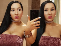 Cặp chị em song sinh chung bạn trai 8 năm tiếc nuối nhan sắc quá khứ vì thẩm mỹ quá đà