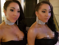 Cặp chị em song sinh chung bạn trai 8 năm tiếc nuối nhan sắc quá khứ vì thẩm mỹ quá đà