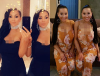 Cặp chị em song sinh chung bạn trai 8 năm tiếc nuối nhan sắc quá khứ vì thẩm mỹ quá đà