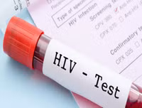 Quy trình xử lý chống phơi nhiễm HIV