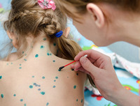 [ẢNH] Cảnh báo những căn bệnh dễ mắc phải khi trời nồm ẩm và cách phòng tránh