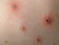 [ẢNH] Cảnh báo những căn bệnh dễ mắc phải khi trời nồm ẩm và cách phòng tránh