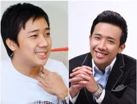 [Ảnh] Ngoại hình mới đầy bất ngờ của dàn ‘sao’ nam Việt sau phẫu thuật thẩm mỹ