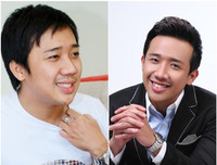 [Ảnh] Ngoại hình mới đầy bất ngờ của dàn ‘sao’ nam Việt sau phẫu thuật thẩm mỹ