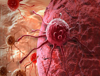 Chế độ ăn uống đẩy lùi bệnh ung thư!