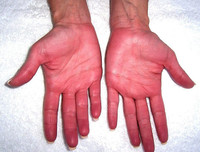 [ẢNH] 12 dấu hiệu bất thường trên cơ thể 